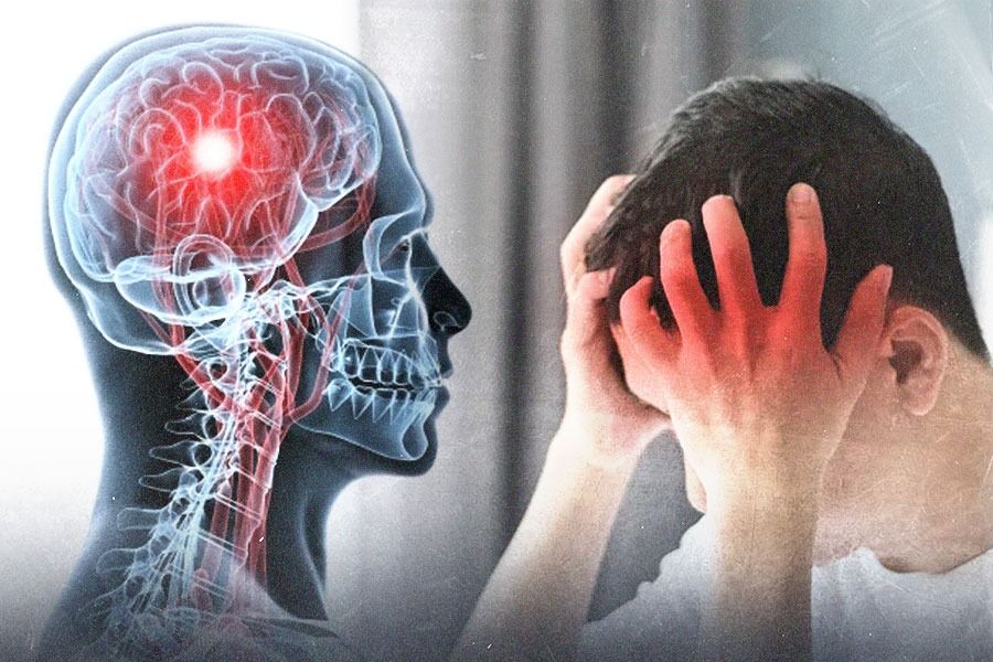 Sekecil apa pun tanda-tanda yang mengindikasikan stroke, termasuk peringatan TIA, tidak boleh diremehkan. (M. Yusuf/Skor.id) 