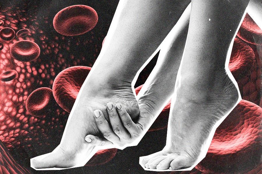 6 Tanda Indikasi Sirkulasi Darah di Kaki Memburuk
