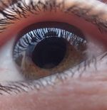Tanda-tanda di Mata Anda yang Bisa Berarti Anda Menderita Diabetes