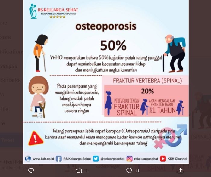 Peneltian menunjukkan penderita oeteoporosis kebanyakan adalah wanita.