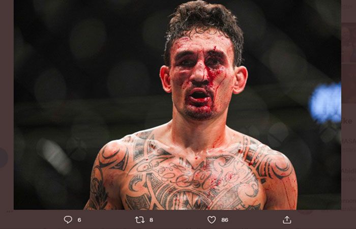  Max Holloway terpaksa berjuang dengan darah mengalir di wajahnya.