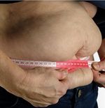 Ilmuwan Menemukan Berbagai Jenis Obesitas, BMI Tinggi Tidak Selalu Sinyal Risiko Kesehatan