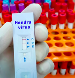 Sederet Fakta yang Perlu Diketahui tentang Virus Hendra, Gejala dan Cara Pencegahan