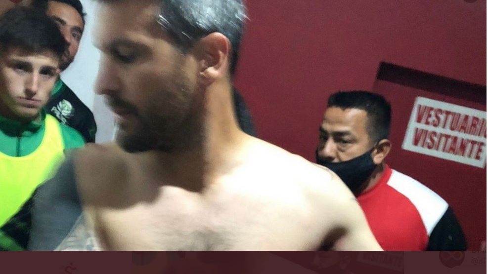 Mauricio Romero, pelatih Ferro de General Pico, dalam perawatan setelah tertembak bagian bawah bahu kirinya.