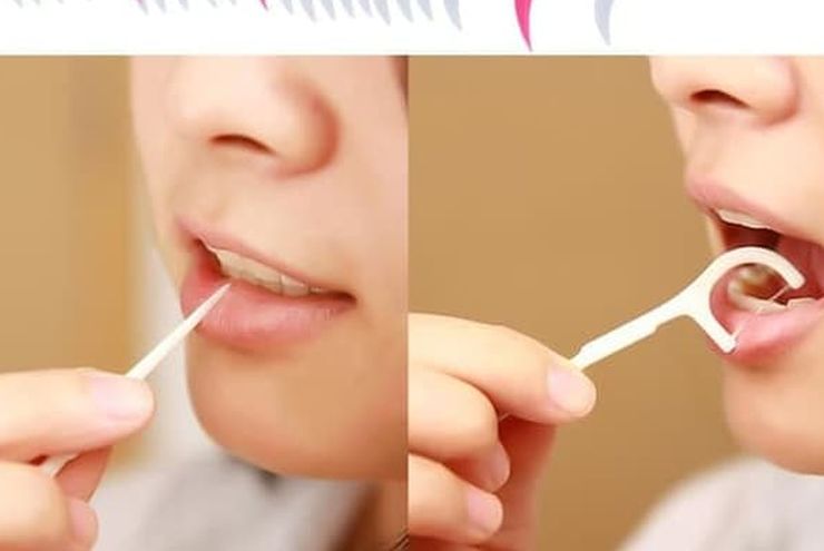5 Jenis Benang Gigi dan Cara Penting Memilihnya