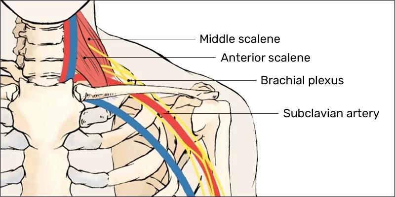 Mengenal Jenis Cedera Atlet Esport: Thoracic Outlet Syndrome