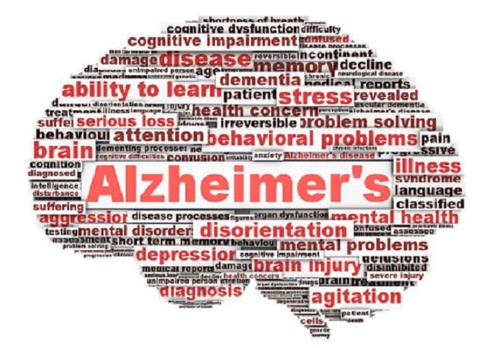 5 Cara Mengurangi Risiko Terkena Alzheimer