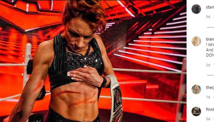 Bintang WWE Becky Lynch Terluka Disayat Rambut Bianca Belair