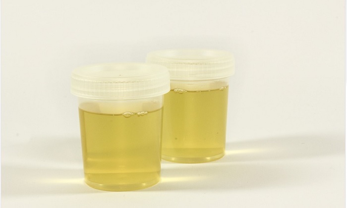 Cek Warna Urine Anda, 9 Fakta Penting yang Terkait Kesehatan Anda